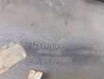 Бампер передний для Hyundai Santa Fe (TM) 2018>, OEM 86511S1500 - вид 6 (фото)
